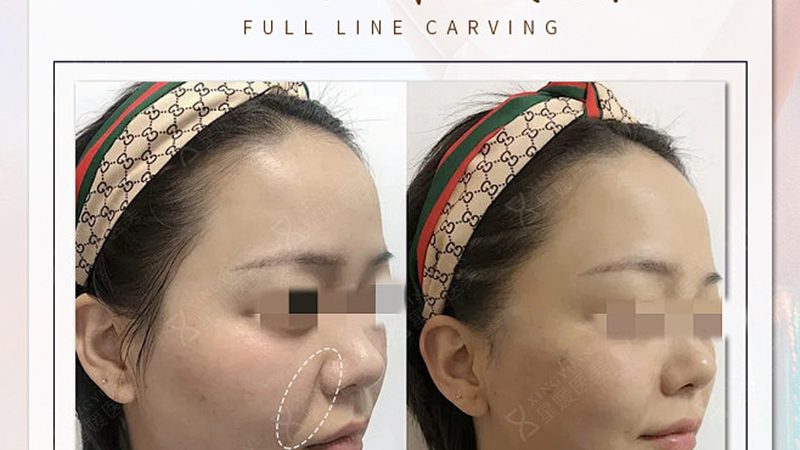 皮肤管理VS美容：如何选择适合自己的方案？**