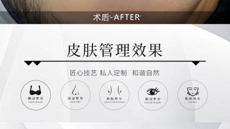 小标题：双眼皮贴导致松弛的原因