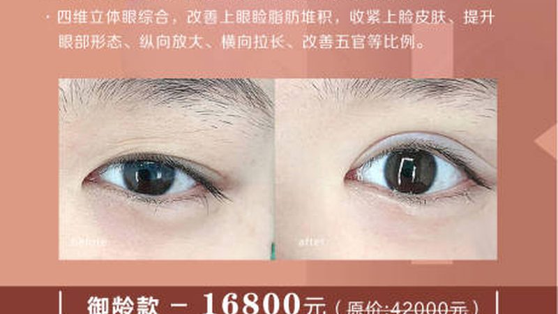 抗衰美容仪哪个牌子效果明显