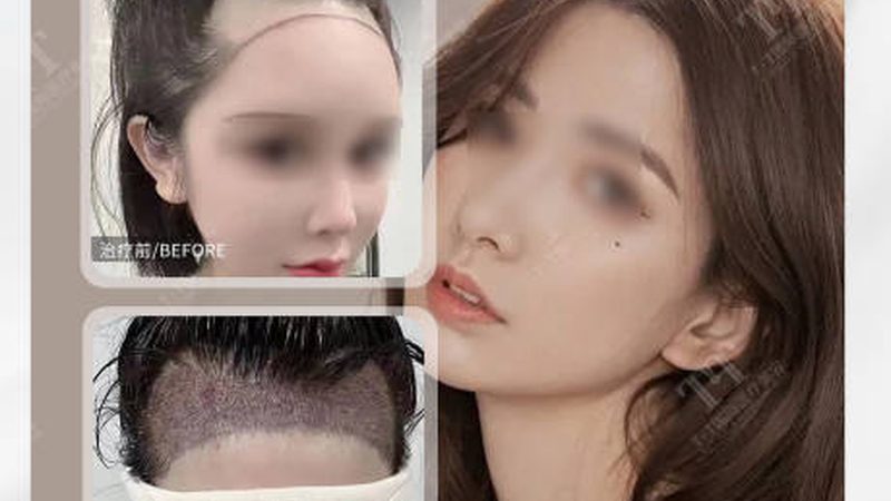 郑州注射美容医院对比分析