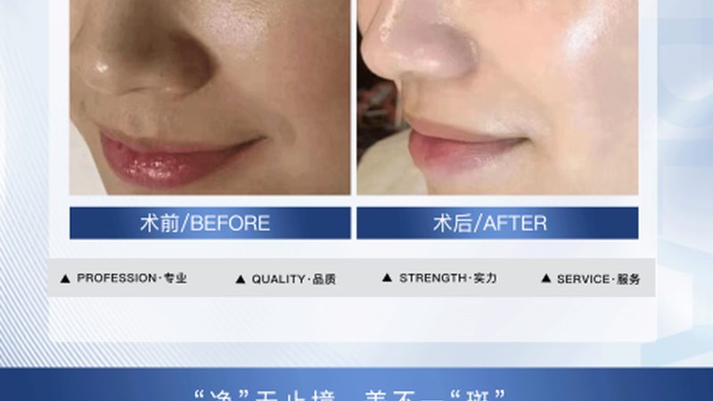 南京皮肤美容整形医院品牌分类揭秘