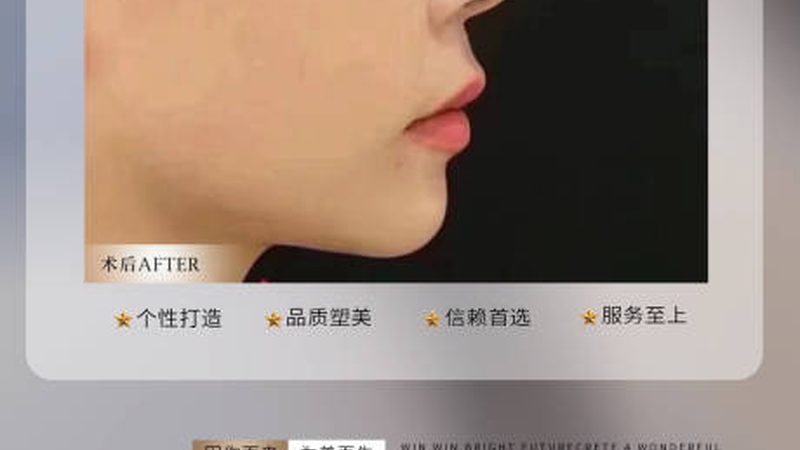 揭秘医美产品批发价格：揭秘行业真相，避免踩坑