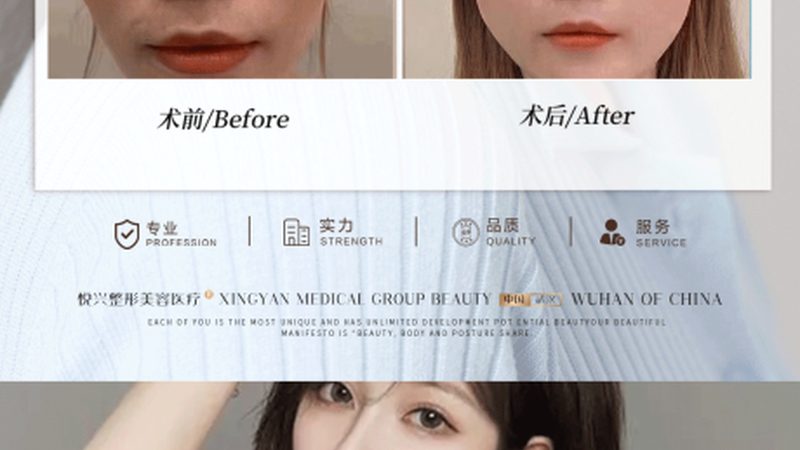 整形美容术前体检，安全塑形的第一步