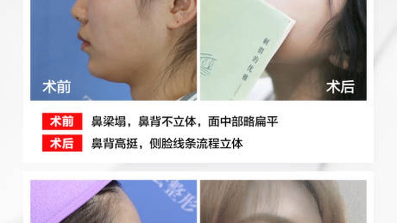 成都超声炮治疗，揭秘其价格背后的技术秘密