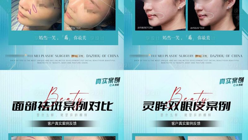 无论是光子嫩肤还是激光嫩肤，术后都需要注意以下事项：