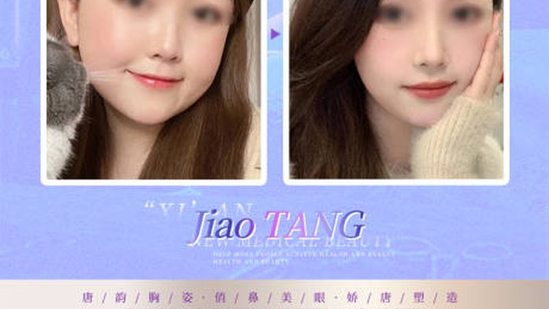 玻尿酸注射后，这些注意事项你做到了吗？**