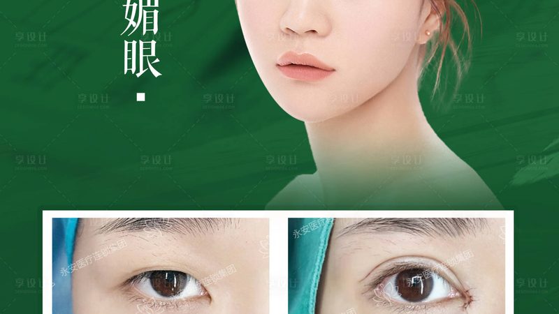 激光祛斑手术：了解副作用，选择专业医院