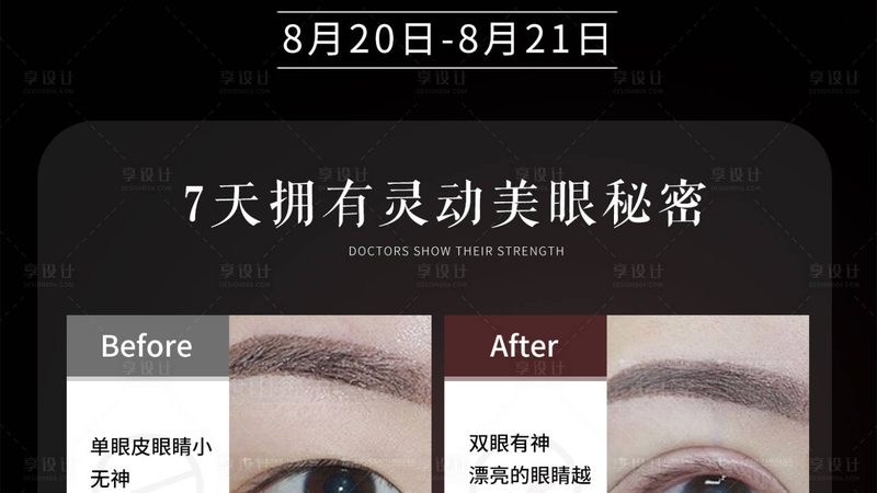 热玛吉探头定制：揭秘其优缺点与选型逻辑