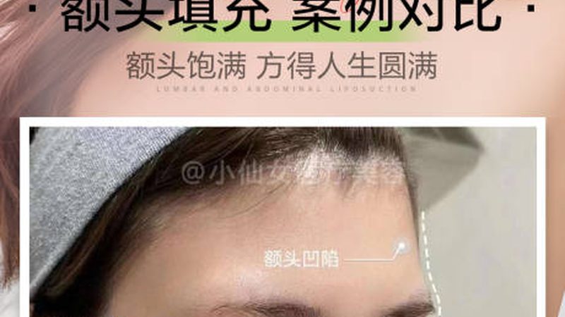 激光祛斑后，这些注意事项你做到了吗？**